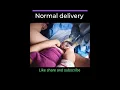 Download Lagu Normal delivery in Hospital #baby #shorts #pregnancy #viral #medical