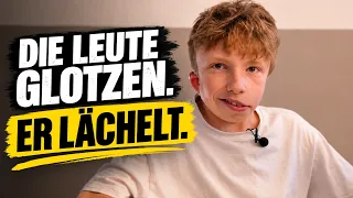 Leben mit dem GOLDENHAR-Syndrom | Fynn versteckt sich nicht!