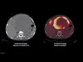 Nuclear medicine physics and applications