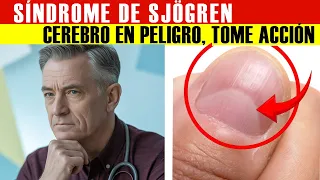 ¡El síndrome de Sjögren está dañando tu CEREBRO SECRETAMENTE!