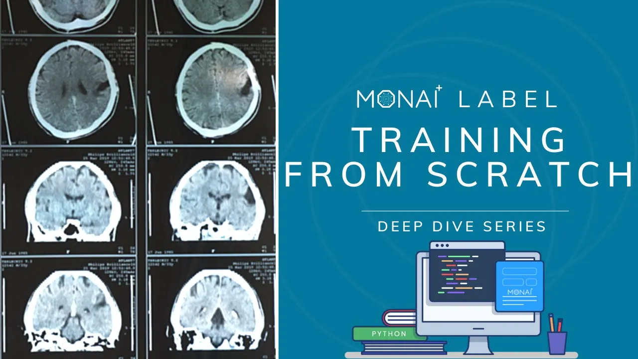 MONAI Label - Training from Scratch