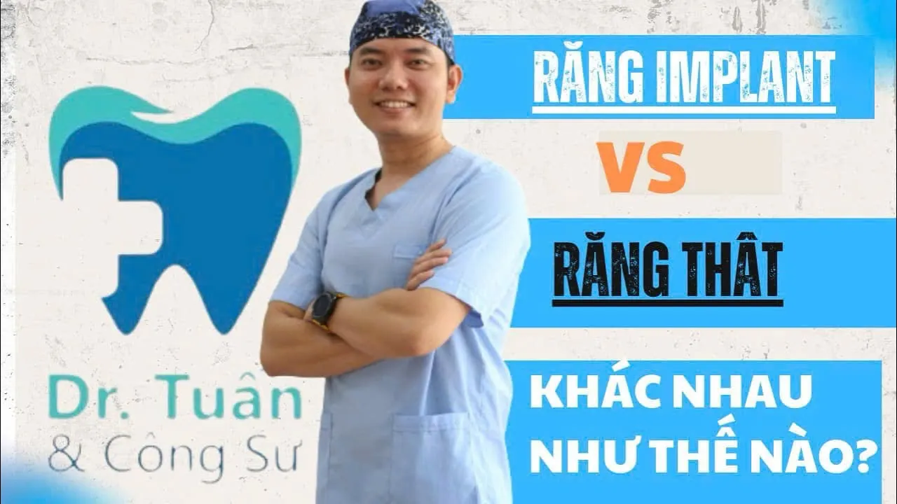 Outline Video So sánh Implant và Răng Thật: Điều Bạn Cần Biết!