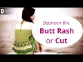 Intertrigo Risk Factors Causes Symptoms and Treatment - Dr Rajdeep Mysore