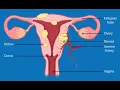 Myomectomy CPT code - simplify medical coding