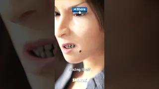 لا تلمس شامتك لماذا لا يجب أن تقطع شامة بنفسك صحة نصائح طبية شامات 