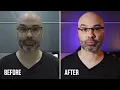 Download Lagu Betere verlichting voor uw livestreams en YouTube-video's