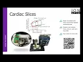 IonOptix MyoClamp System - Cardiac Slices