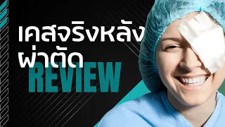  อาการตาแห้งและเคืองตาเป็นเวลานานเกิดจากสาเหตุอะไรได้บ้าง 