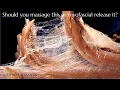 Myofascial release vs massage St Louis chiropractor explains fascia