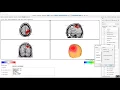 EEG Intro to NeuroNavigator Normative Database
