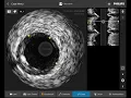 IntraSight Intuitive Interface