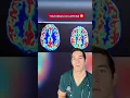 Download Lagu How caffeine REALLY affects the brain
