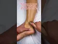 IF THIS AREA IS EXTREMELY PAINFUL PAY ATTENTION