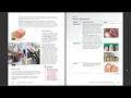 Milady Cosmetology Ch 6 Pages 114-124 Nail Disorders Diseases