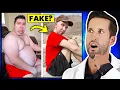 ER Doctor REACTS to Nikocado Avocado Weight Loss