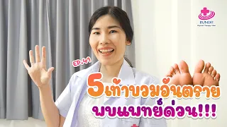 อาการเท้าบวมที่ควรรีบพบแพทย์โดยด่วนมีอะไรบ้าง