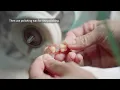 Workflow Guide 3D Printing Flexible Dentures