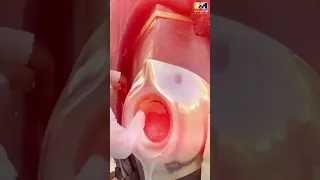 مهنه تعطير الحجر الاسود شرف لايقدر بثمن ابوكبير ميديا دويتو 