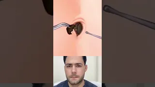 تنظيف السرة اكسبلور 