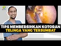 Tips Membersihkan Kotoran Telinga Yang Tersumbat | Dokter Tht