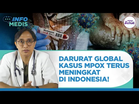 Mudah Menular, Begini Upaya Pencegahan Virus Monkeypox!