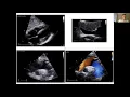 PNCS 1 Tutorial Echo Anatomy