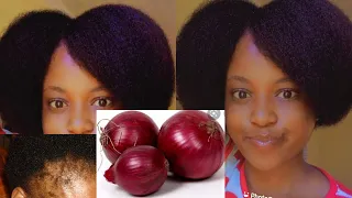 jinsi ya kukuza na kujaza nywele kwakutumia kitunguu naturalhair onion kuzanyweleharaka