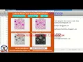 Leukemia Blood Cancer Detection Using Image Processing With Source Code Matlab Project Leukemia