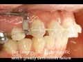 Securus orthoTAD Intro movie
