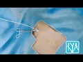Chest Port Placement