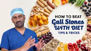 Best Diet tips for Gallstones Dr Parthasarathy