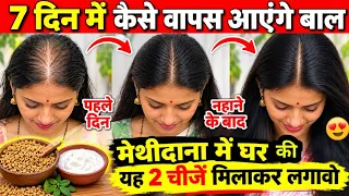 7 Days Challenge : कितने भी पतले कमजोर झड़ते बाल हों, इस रेमेडी से उगेंगे दोगुनी तेजी से बाल❤️