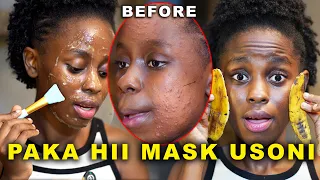 kuondoa chunusi usoni na makovu kwa haraka how to get rid of acne