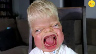 Michael The Miracle The Boy Doctors Said Wouldn T Survive 