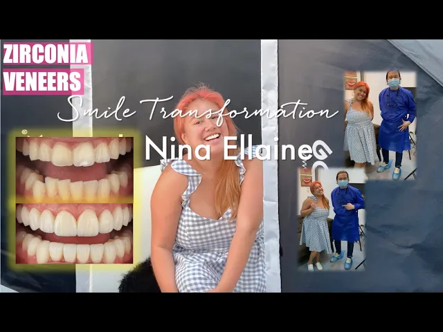 CEO of Colourette Cosmetics Nina Ellaine got Zirconia Veneers
