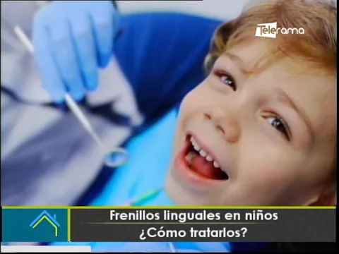Frenillos linguales en niños ¿Cómo tratarlos?