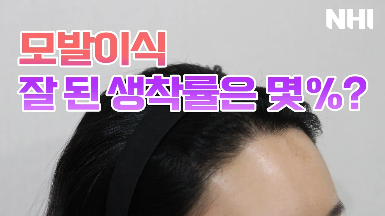 (Eng) 모발이식! 진짜 10개 심으면 10개 다 날까?ㅣ뉴헤어 [모발이식][모발이식후기]