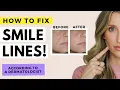How to Fix Wrinkles Around the Mouth Smile Lines and Sagging Skin Dr Sam Ellis