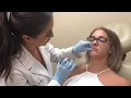 Lip Augmentation with Fillers in Long Island at Deep Blue Med Spa