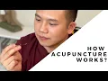 What is Acupuncture And does it Work