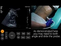 Ultrasound Tutorial Kidney Bladder Urinary Tract Radiology Nation
