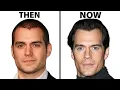 Is Henry Cavill s Face All Natural Plastic Surgery Analysis