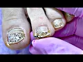 Gel Pedicure for Professional Dancer