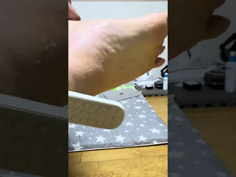 거친 발뒤꿈치 순삭! 역대급 각질 제거 ASMR 🦶✨