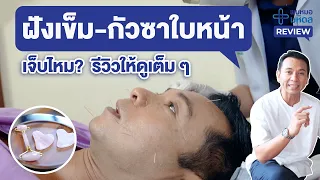 รีวิวแพทย์แผนจีน : ดูแลผิวหน้าด้วยการฝังเข็ม และกัวซาหน้า | พบหมอมหิดล Review