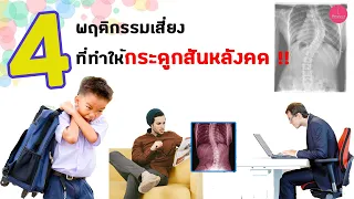  กระดูกสันหลังคดเกิดจากพฤติกรรมอะไรบ้าง 
