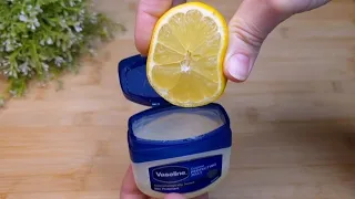 mix vaseline with lemon and you will be shocked if only i had known about this earlier 