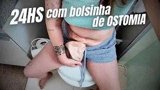 MEU DIA COM OSTOMIA - 24hs com uma bolsinha de ileostomia 💩