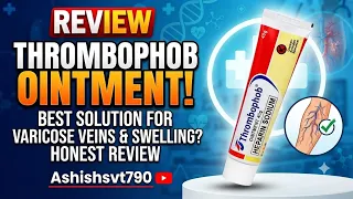 Thrombophob Ointment Review In Hindi | सूजन की क्रीम