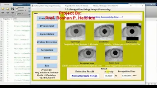 Iris Recognition Using Image Processing Matlab Project Source Code Final Year Project